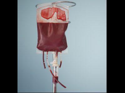 AQuAS publică o nouă recomandare a inițiativei Essential pentru a preveni transfuziile inutile de sânge