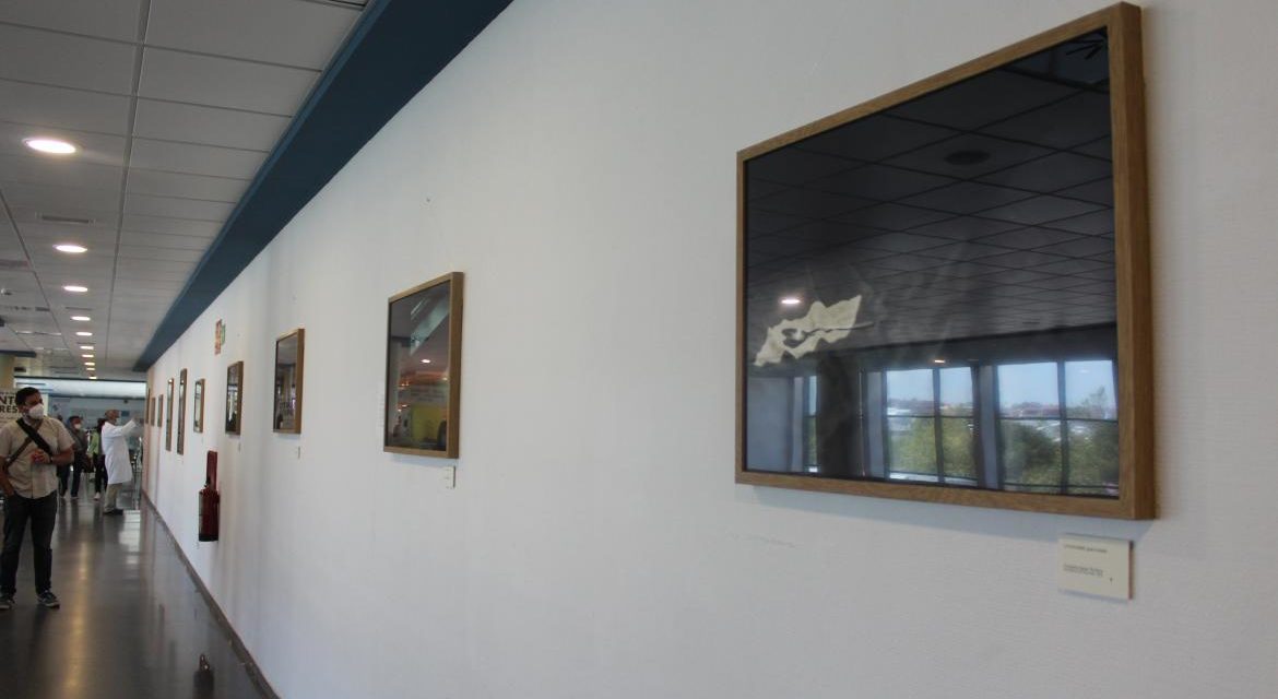 Spitalul Universitar Puerta de Hierro Majadahonda găzduiește expoziția „12 linguri”, o călătorie vizuală prin emoțiile unui pacient cu lupus