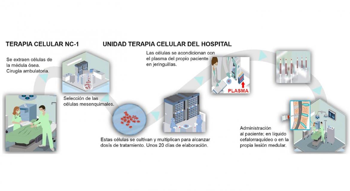 Utilizarea terapiei celulare NC1 în Comunitatea Madrid