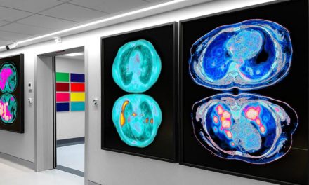 Serviciul de Medicină Nucleară al Spitalului Gregorio Marañón lansează un proiect de umanizare prin art