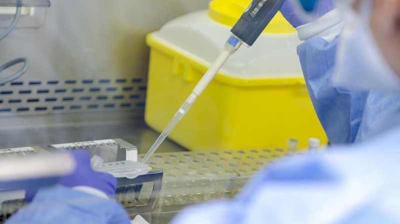 Un studiu al Spitalului Gregorio Marañón susține colectarea de mai multe probe pentru o mai bună detectare a variolei maimuțelor