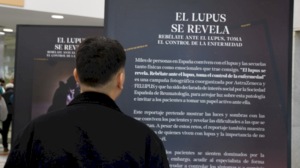 el-hospital-publico-ramon-y-cajal-acoge-la-exposicion-fotografica-itinerante-‘el-lupus-se-revela’