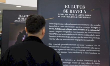 El Hospital público Ramón y Cajal acoge la exposición fotográfica itinerante ‘El lupus se revela’