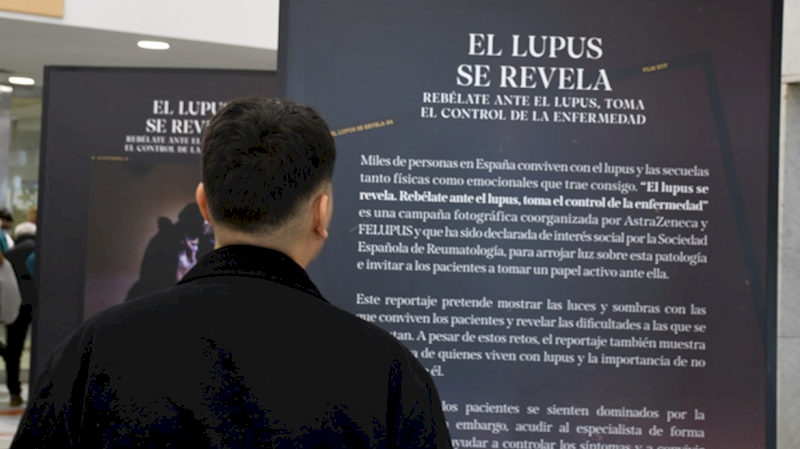El Hospital público Ramón y Cajal acoge la exposición fotográfica itinerante ‘El lupus se revela’